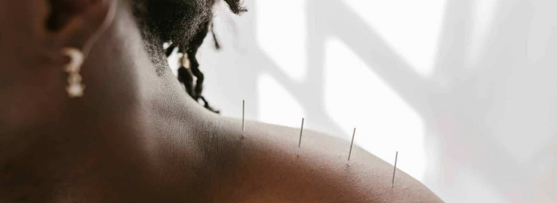 Is Acupuncture Helpful for Overcoming Addiction?